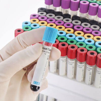 خرید Vacuum EDTA Blood Tubes for Complete Blood Count (CBC) – High Quality, Secure Seal ساخت آنلاین