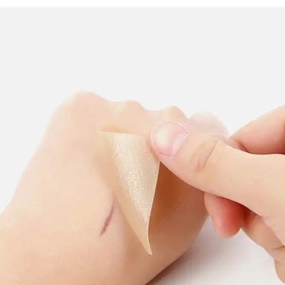 قیمت مناسب ورق های زخم سیلیکونی، نوار، نوار - درمان کلوئید، بخش سزارین، جراحی شکم - درمان زخم جراحی آنلاین